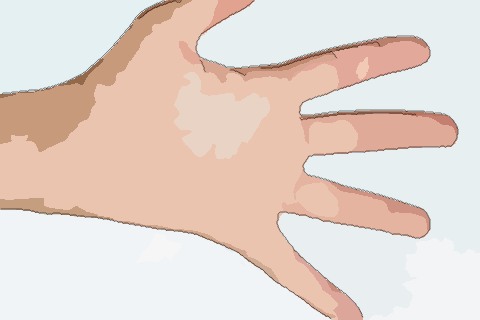 手相手纹杂乱代表什么意思 手纹乱的人命运怎样