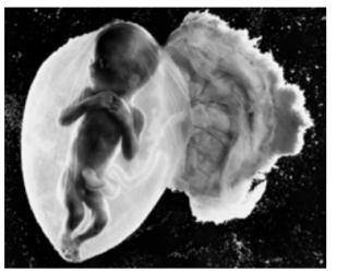 什么是胎息法？