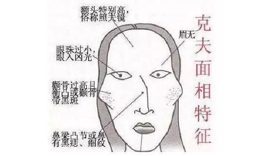 怎么化解克夫痣