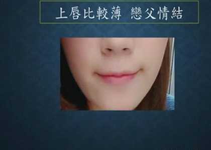 左颧骨有痣的女人面相