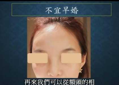 左颧骨有痣的女人面相